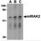 Interleukin 1 Receptor Associated Kinase 2 antibody, TA306247, Origene, Western Blot image 