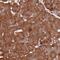 Component Of Oligomeric Golgi Complex 4 antibody, PA5-60016, Invitrogen Antibodies, Immunohistochemistry frozen image 