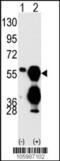 Protein Phosphatase, Mg2+/Mn2+ Dependent 1F antibody, 63-482, ProSci, Western Blot image 