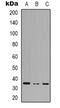 RASD Family Member 2 antibody, abx133607, Abbexa, Western Blot image 