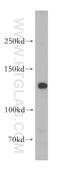 NODAL Modulator 1 antibody, 17792-1-AP, Proteintech Group, Western Blot image 