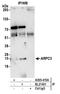 Actin Related Protein 2/3 Complex Subunit 3 antibody, A305-415A, Bethyl Labs, Immunoprecipitation image 
