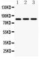 Integrin Subunit Beta 2 antibody, PA1124, Boster Biological Technology, Western Blot image 