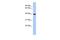 Stomatin-like protein 3 antibody, GTX45686, GeneTex, Western Blot image 