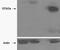 Tankyrase 2 antibody, EB02504, Everest Biotech, Western Blot image 