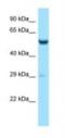 Zinc Finger CCCH-Type Containing 10 antibody, NBP1-98380, Novus Biologicals, Western Blot image 