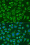Fc Fragment Of IgG Receptor IIIb antibody, 15-304, ProSci, Immunofluorescence image 