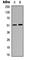 Gamma-Aminobutyric Acid Type A Receptor Alpha6 Subunit antibody, abx133001, Abbexa, Western Blot image 