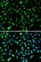 NME/NM23 Nucleoside Diphosphate Kinase 1 antibody, LS-C330879, Lifespan Biosciences, Immunofluorescence image 