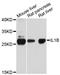 Interleukin 1 Beta antibody, A13268, ABclonal Technology, Western Blot image 