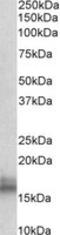 NPC Intracellular Cholesterol Transporter 2 antibody, LS-C139762, Lifespan Biosciences, Western Blot image 