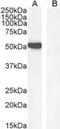 GATA Binding Protein 1 antibody, NB100-2443, Novus Biologicals, Western Blot image 