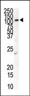 Fms Related Tyrosine Kinase 3 antibody, PA5-14667, Invitrogen Antibodies, Western Blot image 