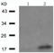 Non-A beta component of AD amyloid antibody, TA321111, Origene, Western Blot image 