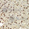 DEAD-Box Helicase 5 antibody, A5296, ABclonal Technology, Immunohistochemistry paraffin image 