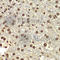 Probable ATP-dependent RNA helicase DDX5 antibody, A5296, ABclonal Technology, Immunohistochemistry paraffin image 