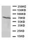 Estrogen Receptor 2 antibody, PA1126, Boster Biological Technology, Western Blot image 