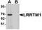 Leucine Rich Repeat Transmembrane Neuronal 1 antibody, LS-C144315, Lifespan Biosciences, Western Blot image 