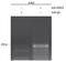 Histone Deacetylase 8 antibody, AF4359, R&D Systems, Chromatin Immunoprecipitation image 