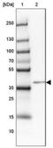 One Cut Homeobox 1 antibody, NBP1-91998, Novus Biologicals, Western Blot image 