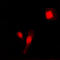 Matrix Metallopeptidase 2 antibody, LS-C352523, Lifespan Biosciences, Immunofluorescence image 