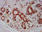 Zinc Finger MIZ-Type Containing 1 antibody, LS-C681736, Lifespan Biosciences, Immunohistochemistry paraffin image 