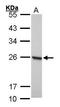Peroxiredoxin 1 antibody, GTX101705, GeneTex, Western Blot image 