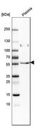 Peptidase Inhibitor 16 antibody, HPA043763, Atlas Antibodies, Western Blot image 