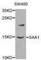 Serum Amyloid A1 antibody, MBS127995, MyBioSource, Western Blot image 