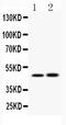 Inhibitor Of Nuclear Factor Kappa B Kinase Regulatory Subunit Gamma antibody, A00874, Boster Biological Technology, Western Blot image 