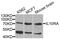 Interleukin 10 Receptor Subunit Alpha antibody, MBS126399, MyBioSource, Western Blot image 