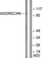 Aggrecan antibody, LS-C121026, Lifespan Biosciences, Western Blot image 