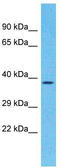 Olfactory Receptor Family 5 Subfamily P Member 2 antibody, TA331609, Origene, Western Blot image 