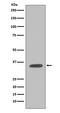 Caspase 7 antibody, M01044-1, Boster Biological Technology, Western Blot image 