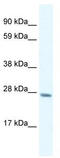 General Transcription Factor IIF Subunit 2 antibody, TA329282, Origene, Western Blot image 