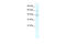 Potassium Channel Tetramerization Domain Containing 10 antibody, 28-280, ProSci, Western Blot image 