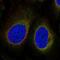 CTD Nuclear Envelope Phosphatase 1 Regulatory Subunit 1 antibody, PA5-67480, Invitrogen Antibodies, Immunofluorescence image 