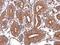 Cutaneous T-cell lymphoma-associated antigen 5 antibody, PA5-29515, Invitrogen Antibodies, Immunohistochemistry frozen image 