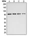 BTB Domain And CNC Homolog 1 antibody, orb213596, Biorbyt, Western Blot image 