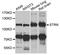 Striatin antibody, A7734, ABclonal Technology, Western Blot image 