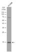 Crystallin Beta A4 antibody, NBP1-32741, Novus Biologicals, Western Blot image 