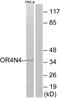 Olfactory Receptor Family 4 Subfamily N Member 4 antibody, GTX87471, GeneTex, Western Blot image 