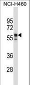 Keratin 6B antibody, LS-C165632, Lifespan Biosciences, Western Blot image 