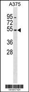 Dual Specificity Phosphatase 10 antibody, 60-804, ProSci, Western Blot image 