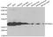 Proteasome Subunit Alpha 5 antibody, A14053, ABclonal Technology, Western Blot image 