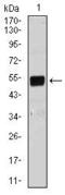 BPI Fold Containing Family B Member 1 antibody, MA5-17125, Invitrogen Antibodies, Western Blot image 