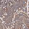 Mitochondrial Ribosomal Protein L48 antibody, NBP2-30586, Novus Biologicals, Immunohistochemistry paraffin image 