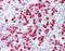 S100 Calcium Binding Protein A8 antibody, orb87482, Biorbyt, Immunohistochemistry paraffin image 