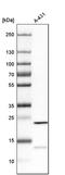 Secretion Associated Ras Related GTPase 1A antibody, PA5-52362, Invitrogen Antibodies, Western Blot image 