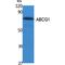 ATP Binding Cassette Subfamily G Member 1 antibody, LS-B14220, Lifespan Biosciences, Western Blot image 